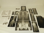 Life-size human x-rays by Cedarville University